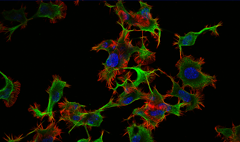 生細胞蛍光イメージングの6つの秘訣 | オリンパス ライフサイエンス